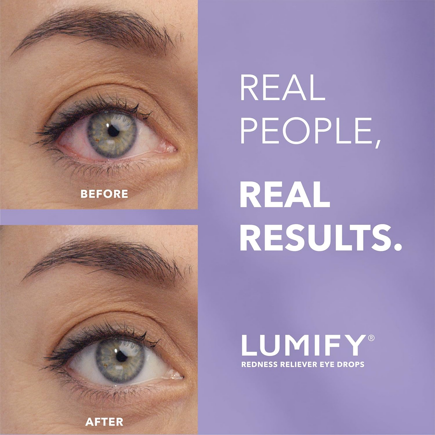 LUMIFY redness reliever eye drops